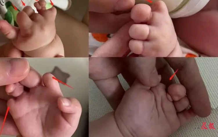 经期血块多吃什么调理 经期血块多吃什么调理最有效